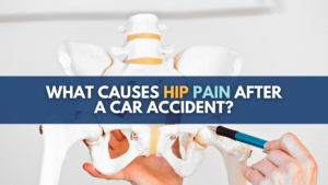 车意外后引起臀部疼痛的是什么
